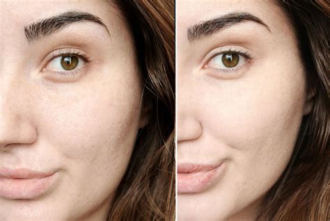 best chanel foundation|chanel foundation before and after.